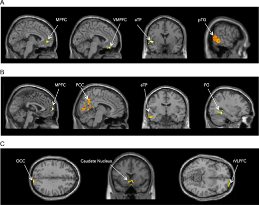 default mode network seed regions figure